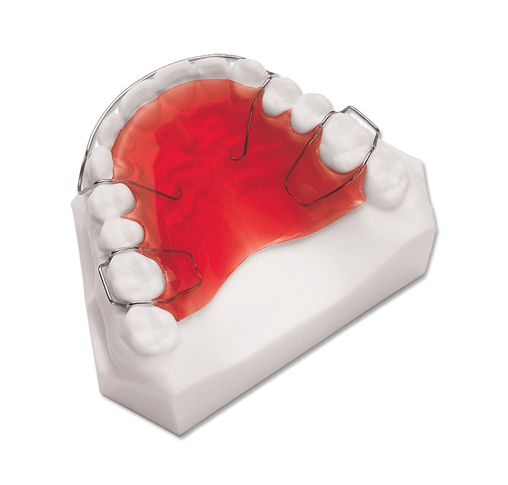  What is an Upper Removable Orthodontic Appliance (URA or Plate)?