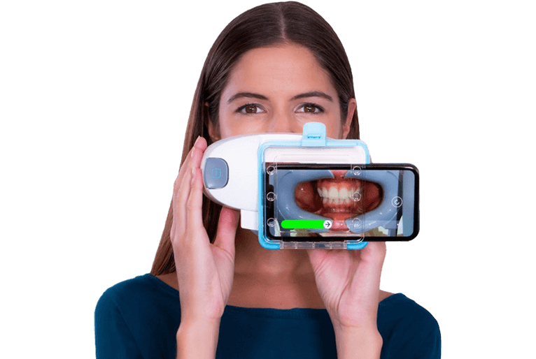  What is Dental Monitoring?
