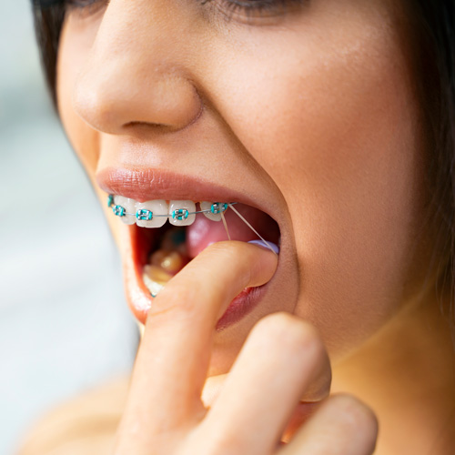  How to wear your elastics
