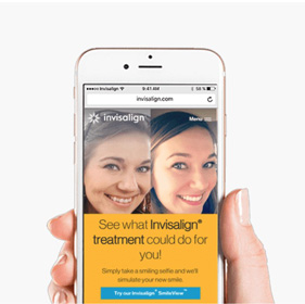 Invisalign® SmileView