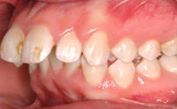 Case 1