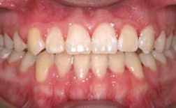 Case 8