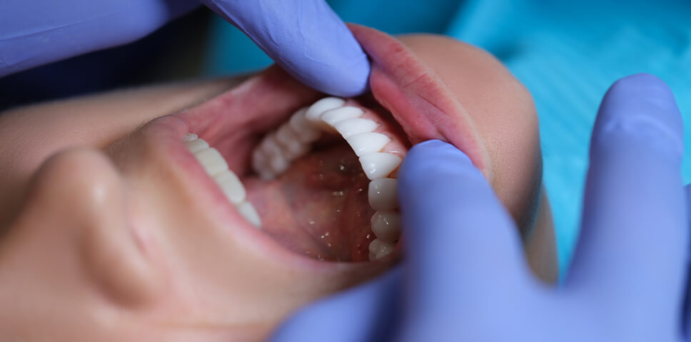 Understanding Jaw Surgery In Melbourne - Costs, Coverage, And When It’s Needed