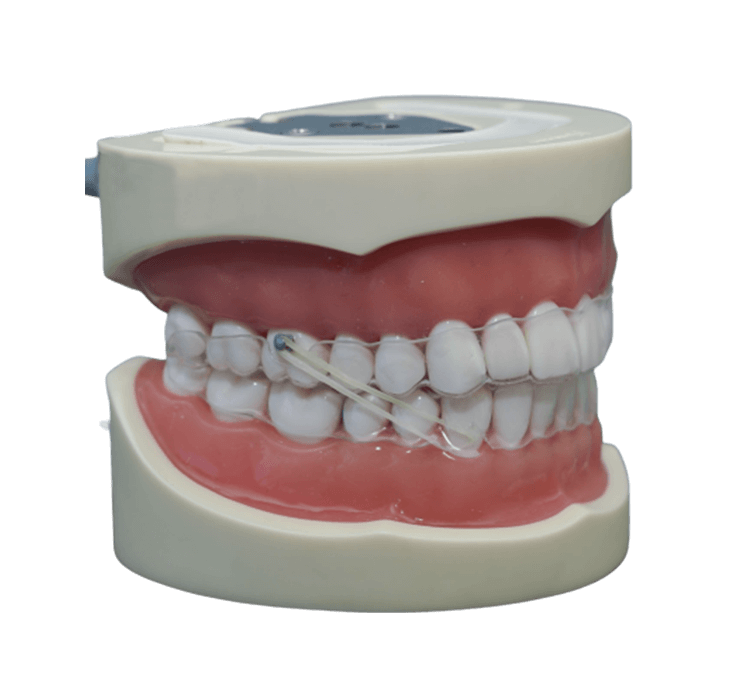  What are elastics?